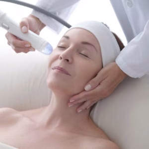 Fresh Glow Starter treatment package - vivace microneedling