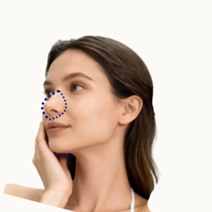 Model woman nose laser hair removal