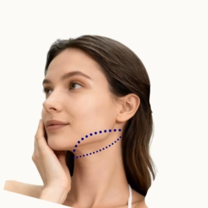Jawline - Laser Hair Removal hair laser woman